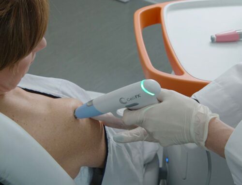 CellFX: Effectively Removing Skin Lesions With Innovative Technology
