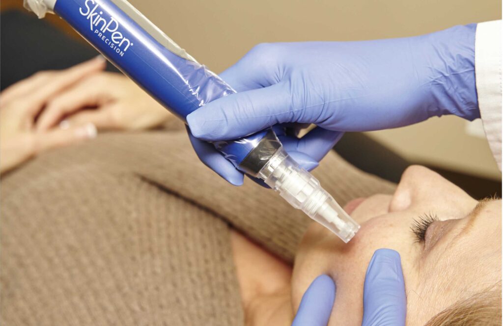skinpen-in-action-1024×665