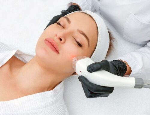 Laser Season Has Arrived: Transform Your Skin At Reno Tahoe Dermatology