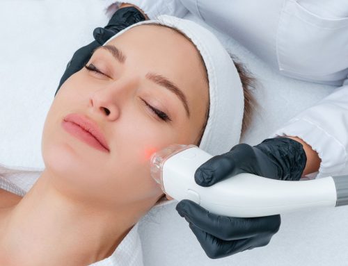 The Best Acne Treatments Available at Reno Tahoe Dermatology