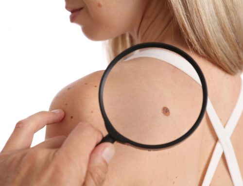 September Is the Best Time for a Skin Check: Mole & Skin Cancer Screening 